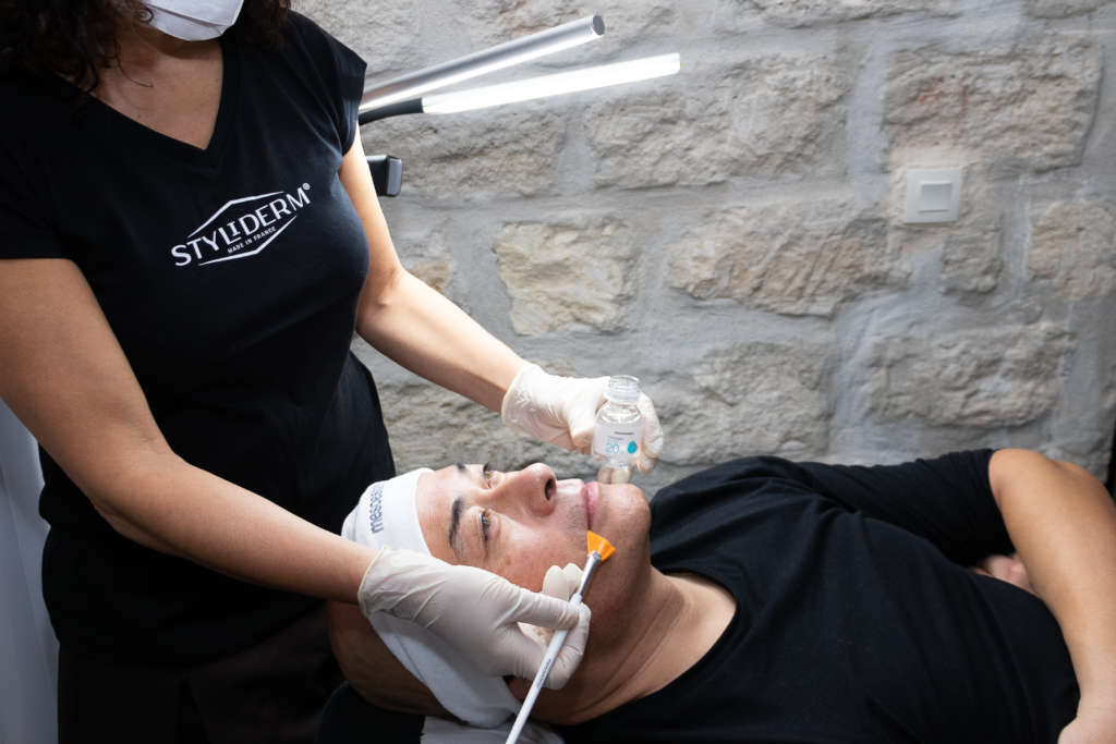 Formation Peeling