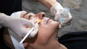 Formation Peeling